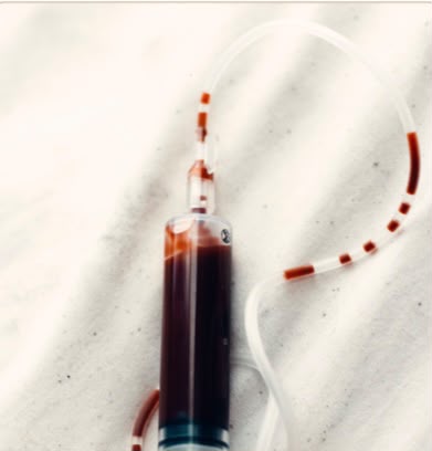 Major Autohemotherapy